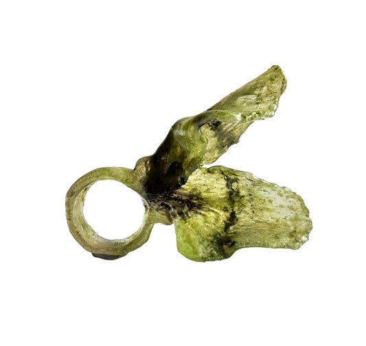 Anello alisio